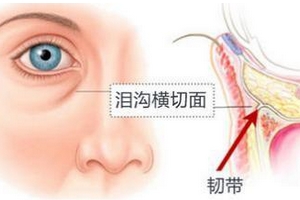 打玻尿酸一个月后肿硬玻尿酸注射一个月后的肿硬现象，原因、处理与注意事项